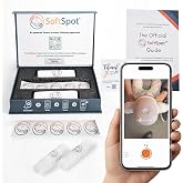 SoftSpot Baby Head Shape Measurement Kit &ndash; Measure at Home, iOS &amp; Android