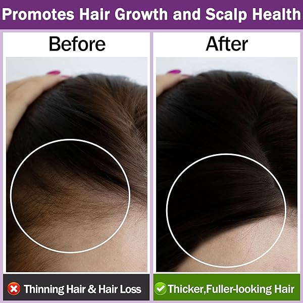 GIFBEA ROSEMARY OIL, 100% PURE UNDILUTED LIGHT-WEIGHT NON-GREASY FOR HAIR, SCALP & SKIN CARE, NATURAL HAIR GROWTH OIL PRODUCTS FOR EYEBROW EYELASH GROWTH , 2 FL OZ