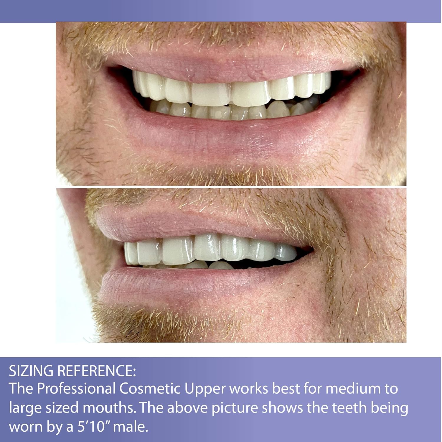 Professional Cosmetic Upper - New from Instant Smile! Hand crafted detail, custom fit at home! Works Best in Medium to Large Sized Mouths. : Beauty