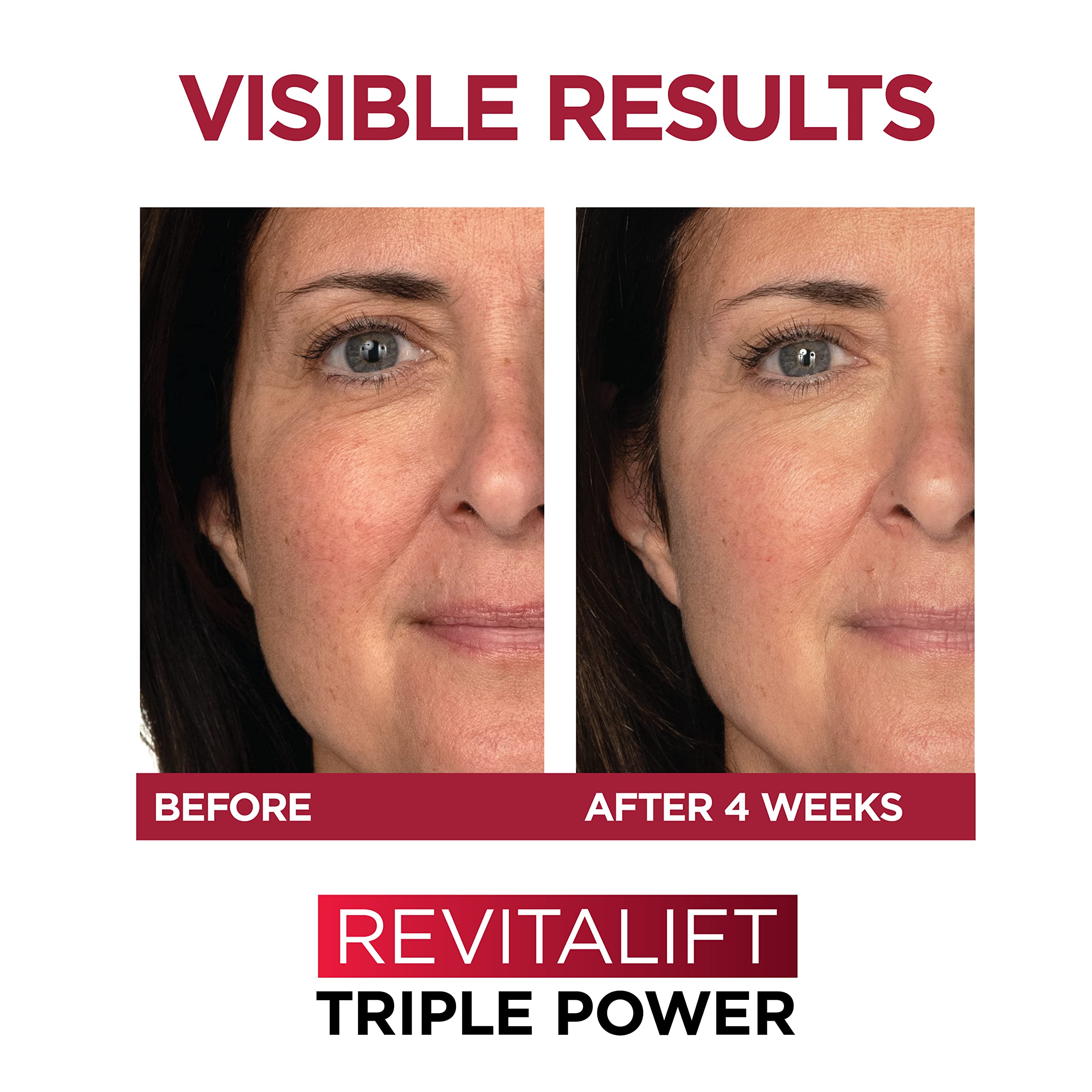 L'Oreal Paris Revitalift 1.5% Pure Hyaluronic Acid Face Serum + Triple Power Anti-Aging Face Moisturizer, 1 kit