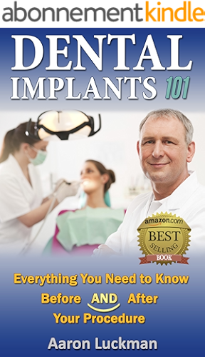Download Dental Implants 101: Everything You Need to Know Before AND After Your Procedure! (English Edition) PDF
