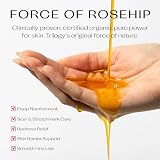 Trilogy Certified Organic Rosehip Oil 20ml USDA Cold Pressed For Skin view 4