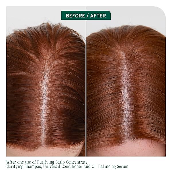 BIOLAGE SCALP SYNC CLARIFYING SHAMPOO – RESIDUE & BUILDUP REMOVER, FOR OILY SCALP, FERMENTED TEA & GLYCOLIC ACID, VEGAN & PARABEN-FREE