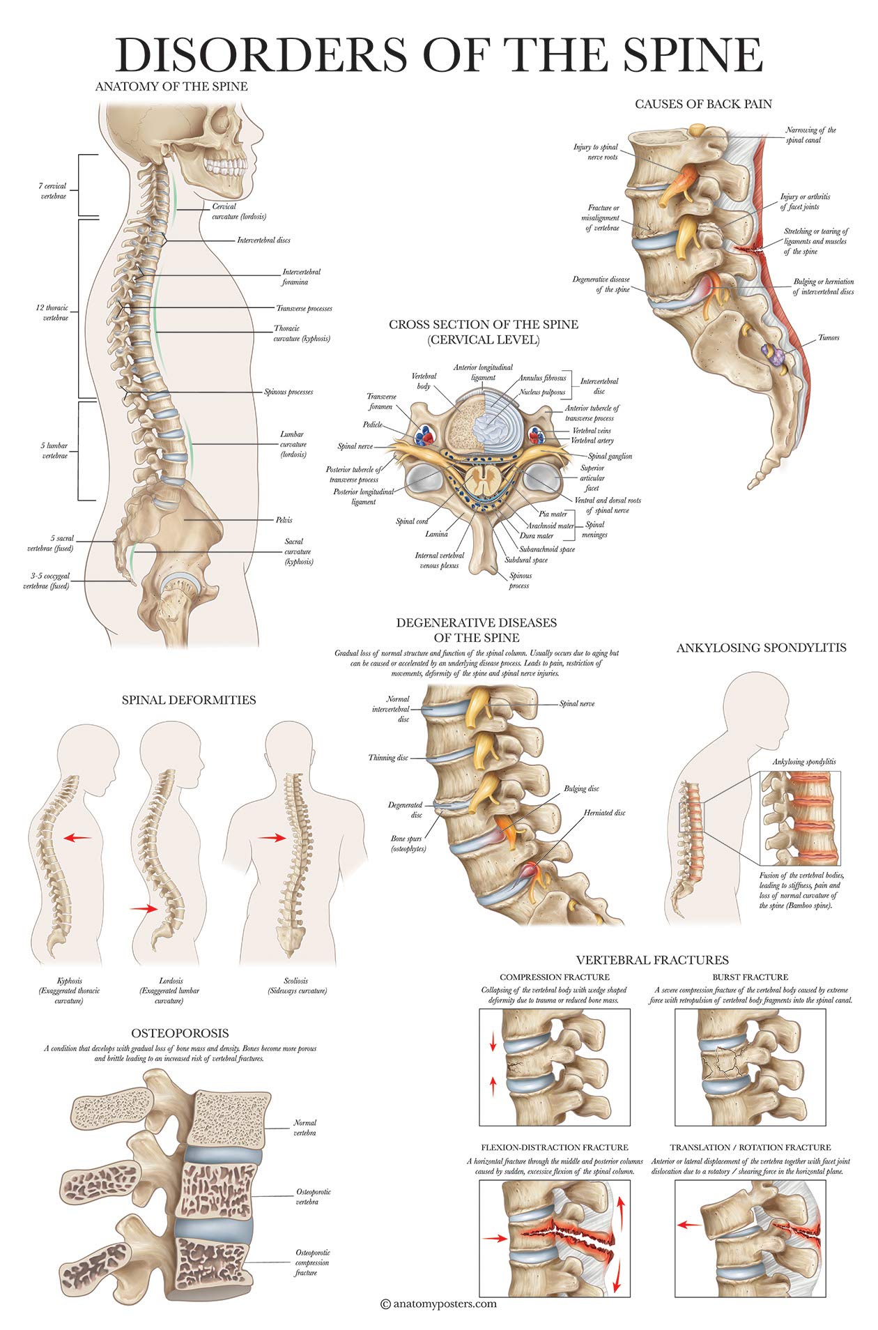 Mua 2 Pack: Spinal and Cranial Nerves + Disorders of the Spine Poster ...