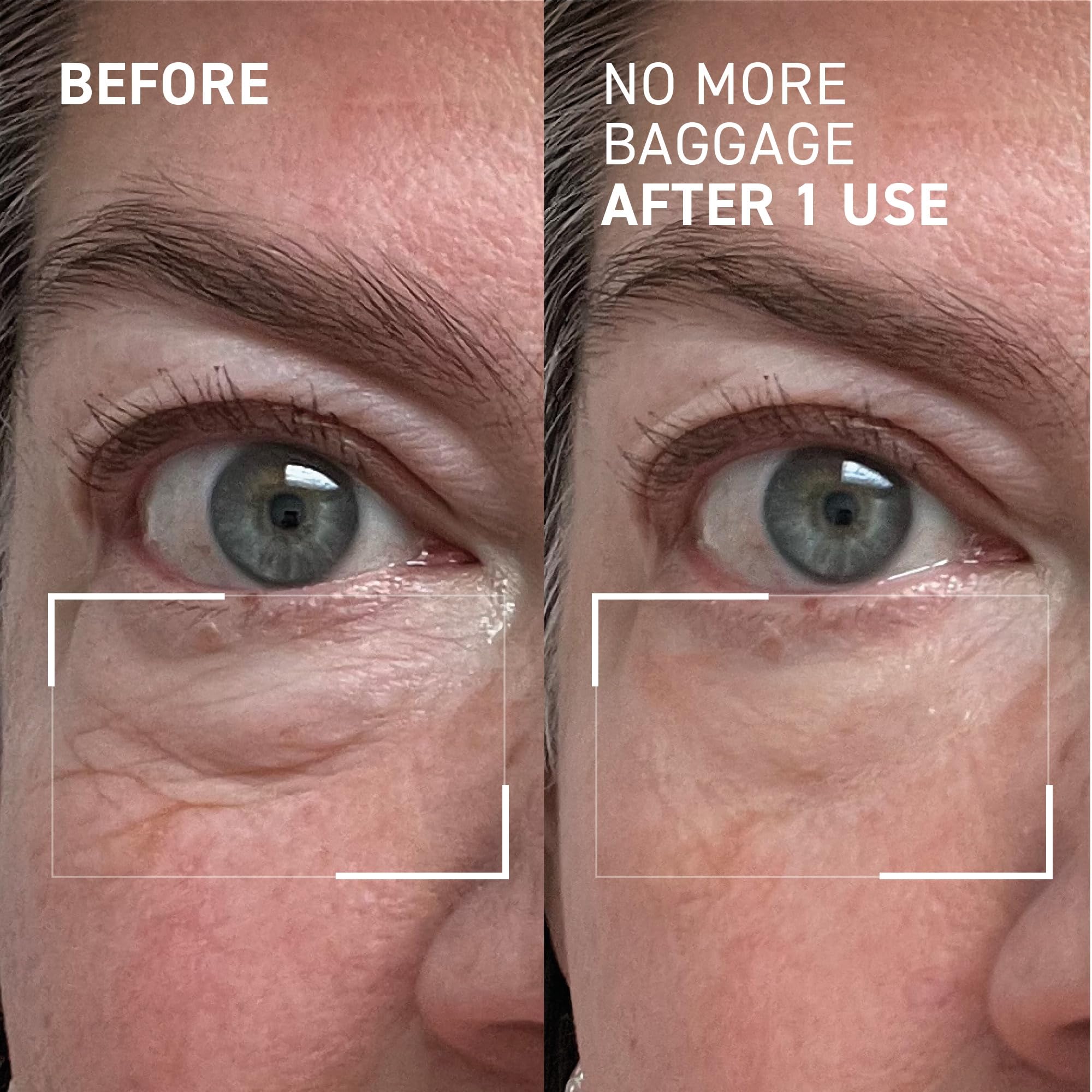 Dr. Brandt Needles No More, No More Baggage - Minimizes Under-Eye Bags, Puffiness & Dark Circles - 0.5 oz