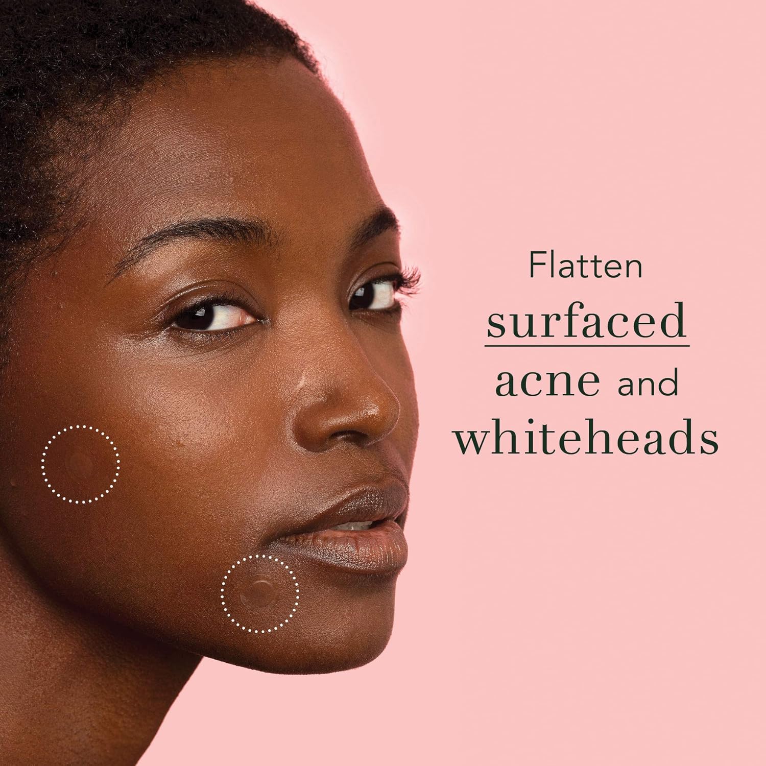 Rael Acne Pimple Healing Patch - Absorbing Cover, Invisible, Blemish Spot, Hydrocolloid, Skin Treatment, Facial Stickers, Two Sizes 10mm & 12mm, Blends in with skin (96 Count): Beauty