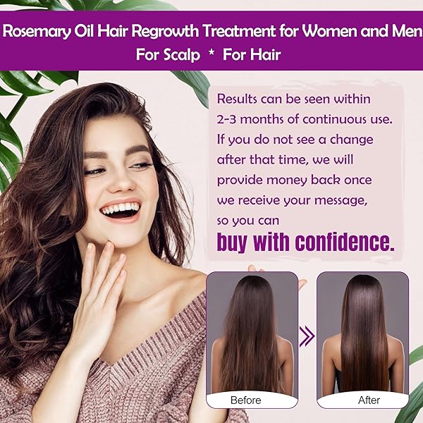 ROSEMARY OIL HAIR GROWTH SERUM W/ROSEMARY WATER & RICE WATER SPRAY HAIR GROWTH,BIOTIN CASTOR OIL ARGAN OIL CAFFEINE KERATIN REDUCE HAIR LOSS,RESTORE DRY DAMAGED HAIR REGROWTH TREATMENTS FOR WOMEN MEN
