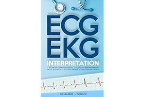 ECG / EKG Interpretation: A Systematic Approach to Read a 12-Lead ECG and Interpreting Heart Rhythms in 15 Seconds or less Wi