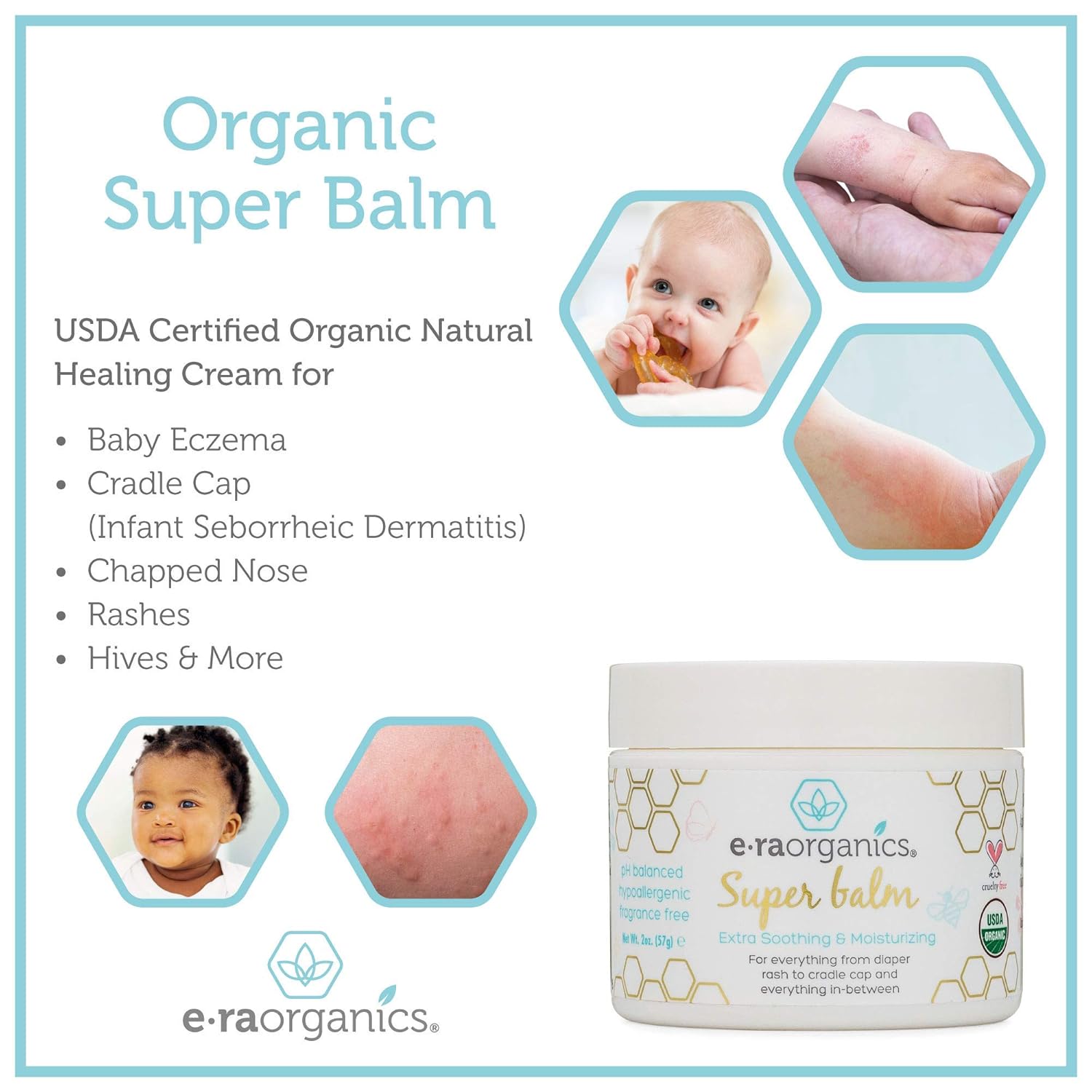 Era Organics Healing Ointment for Babies - USDA Certified Organic Natural Gentle Moisturizer for Sensitive Skin Prone To Baby Eczema, Cradle Cap (Infant Seborrheic Dermatitis), Rashes, Hives & More: Beauty