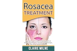 Rosacea Treatment: The Ultimate Guide To Managing And Improving Rosacea Through Diet Changes, Lifestyle, And Remedies