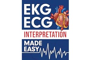 EKG | ECG Interpretation Made Easy: An Illustrated Study Guide For Students To Easily Learn How To Read & Interpret ECG Strip