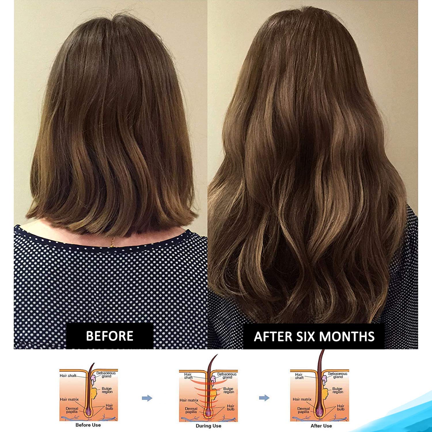Hairgenics Pronexa Clinical Strength Hair Growth & Regrowth Therapy Hair Loss Shampoo With Biotin, Collagen, and DHT Blockers for Thinning Hair, 8 fl. oz.: Beauty
