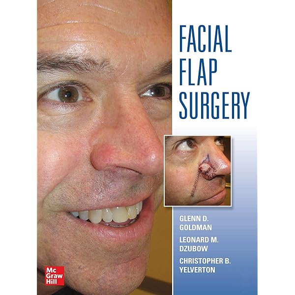 健康・医学 local flaps in facial reconstruction Local Flaps in Facial Reconstruction: Text with DVD