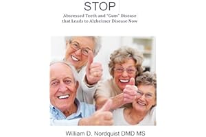 Stop Painful Abscessed Teeth and “Gum” Disease that Leads to Alzheimer’s Disease Now: A guide to understand, prevent and begi