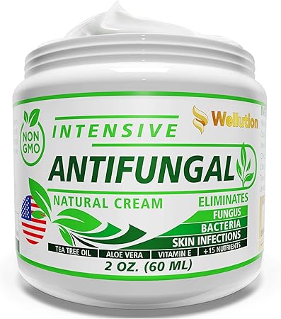herbal antifungal cream