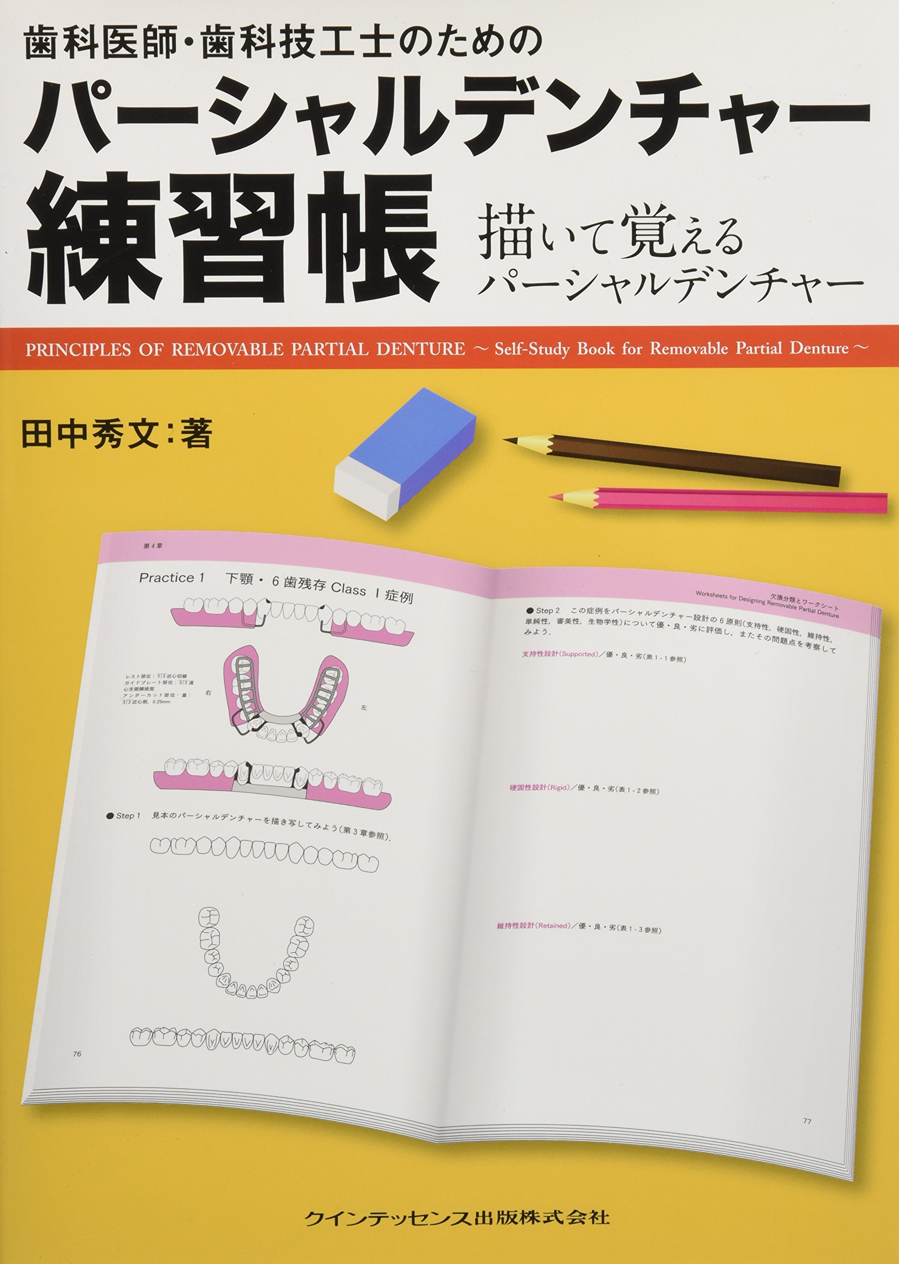 大決算売り尽くし 送料無料 書籍 迷わない 悩まないパーシャルデンチャーのつくり方 欠損パターンで覚えるパーシャルデンチャー Quint Kick Off Librar 代引不可 Wjelaser Com