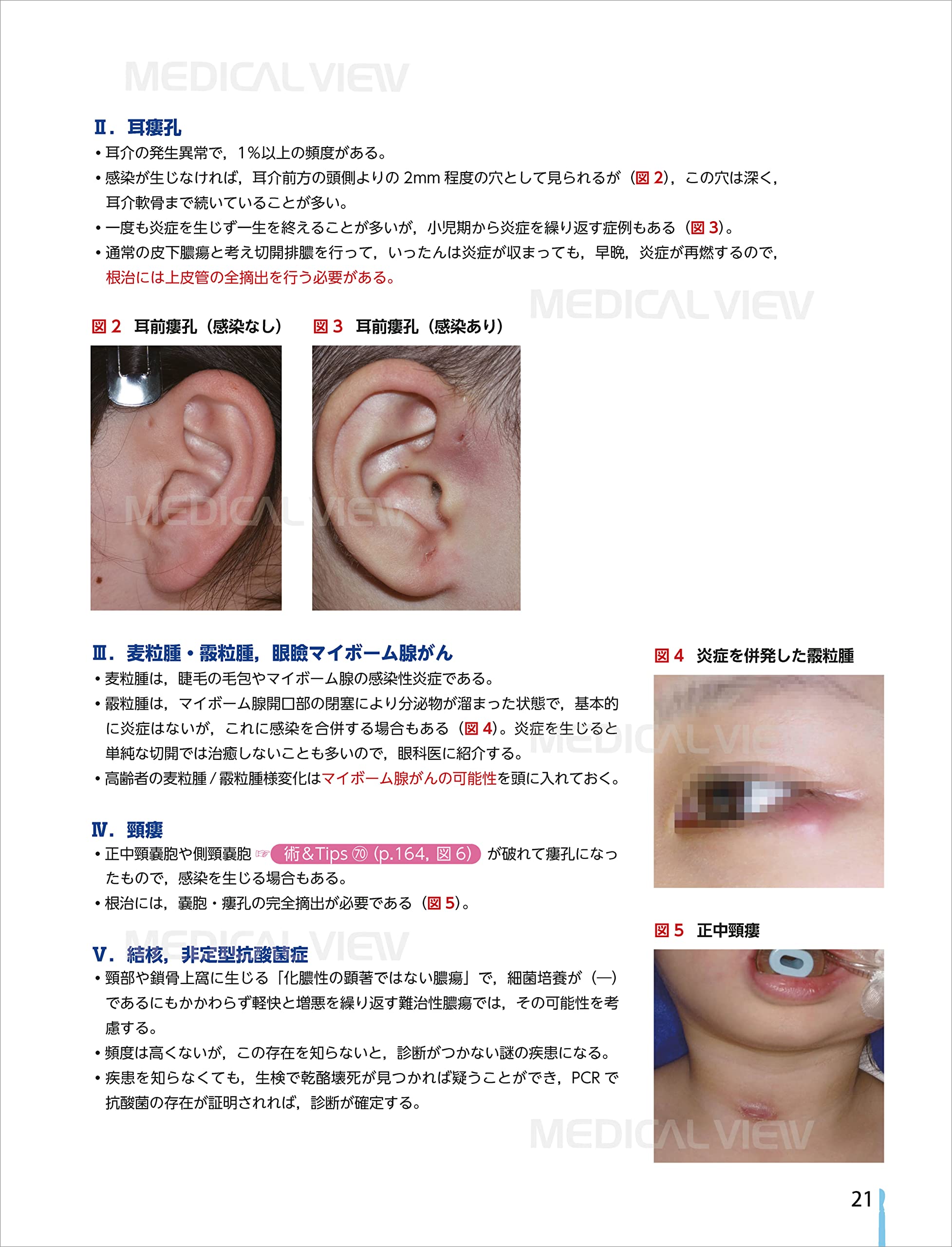 定番の冬ギフト 傷 創 小外科対応の術 Tips ちがい 例外 想定外をひもとく 腎臓 透析 Ternamedical Org