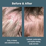 Sea Magik Salicylic Acid Shampoo for Psoriasis & Itchy Scalp 300ml view 3