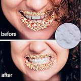 Udewo 100g Temporary Tooth Repair Beads Dental Filler Material view 4