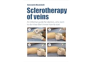 Sclerotherapy of Veins : An informal guide for doctors who want to do it but don't know how to start