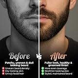 Red-Blooded Beard Roller 0.5mm Titanium Microneedle for Beard Growth & Hair view 9