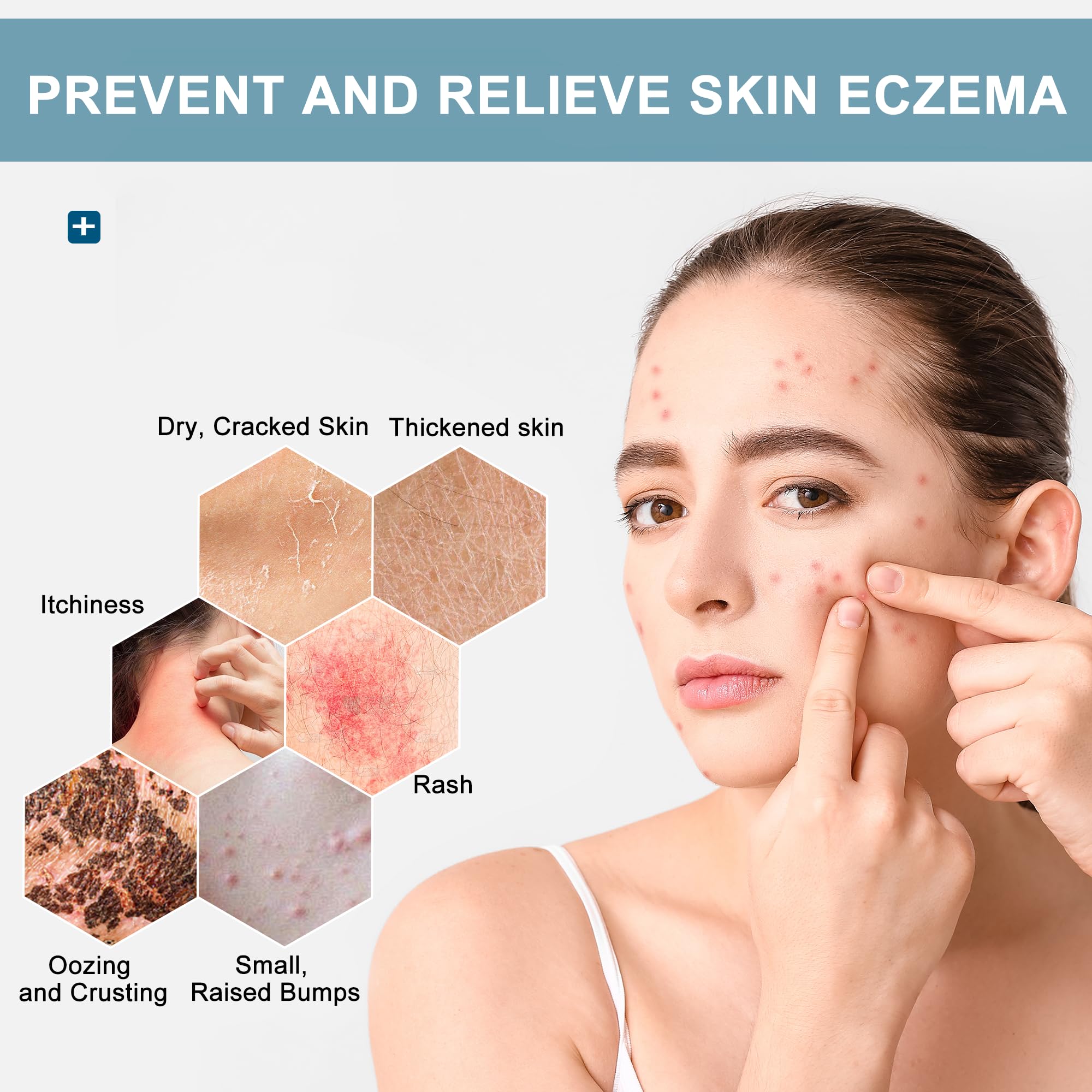 Eczema Wipes All-Natural Fast Acting Eczema Relief, Instantly Soothes & Cools Itching, Cracking, and Drying, Skin Protectant Organic Wipes