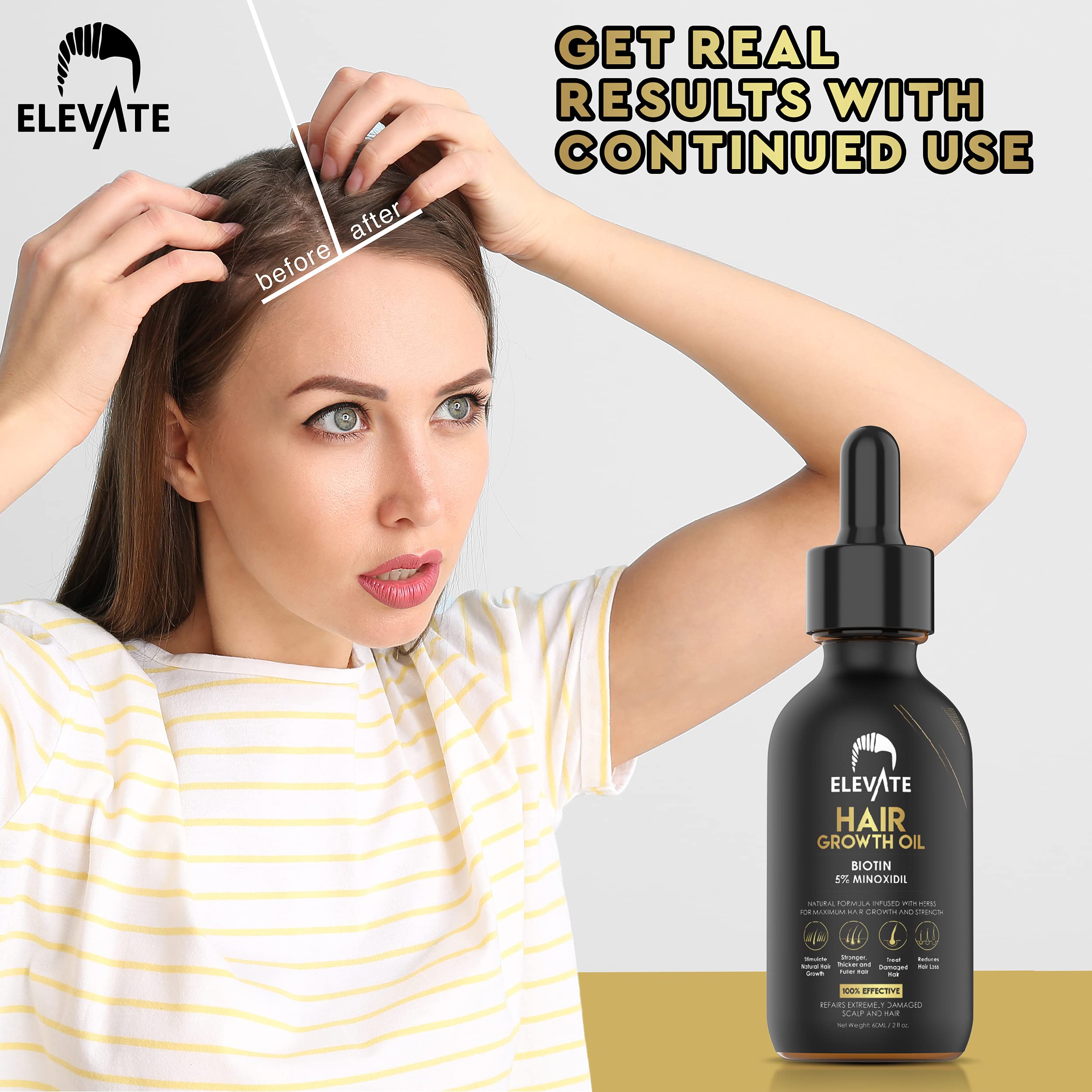 Elevate Hair Regrowth Treatment 5% Minoxidil Serum - Biotin Infused Growth Oil for Men & Women - Stop Thinning & Shedding - Restore Follicle Strength & Density for Fuller, Stronger, Healthier Hair 1oz
