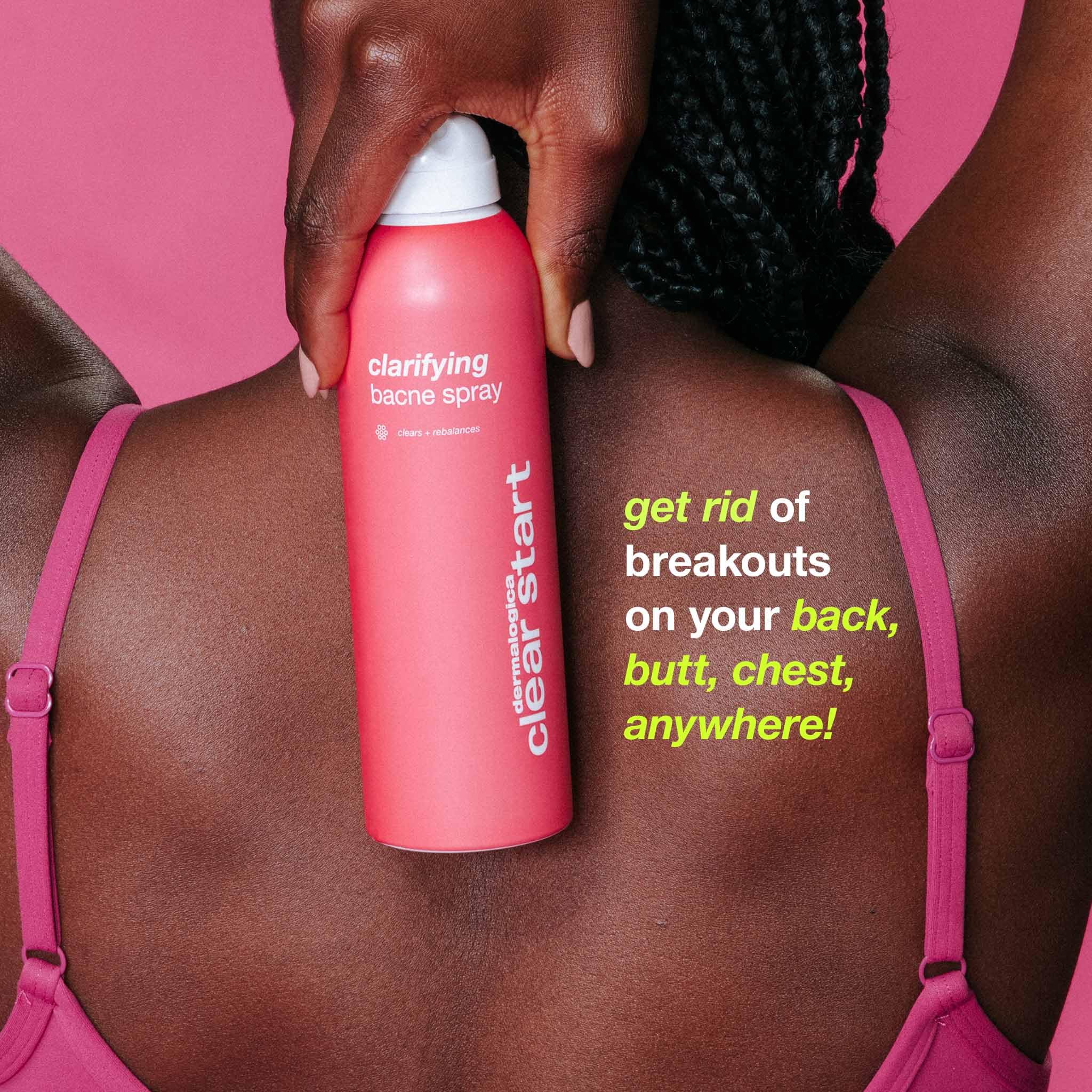 Dermalogica Clear Start Clarifying Bacne Spray, Back Acne Treatment Spray for Body Breakout - Pore Clearing, Preventing Pimple with Salicylic Acid, Witch Hazel, Tea Tree Oil, All Skin Type, 6 fl oz