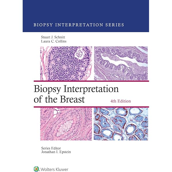 Amazon.com: Rosen's Breast Pathology eBook : Hoda, Syed A., Rosen