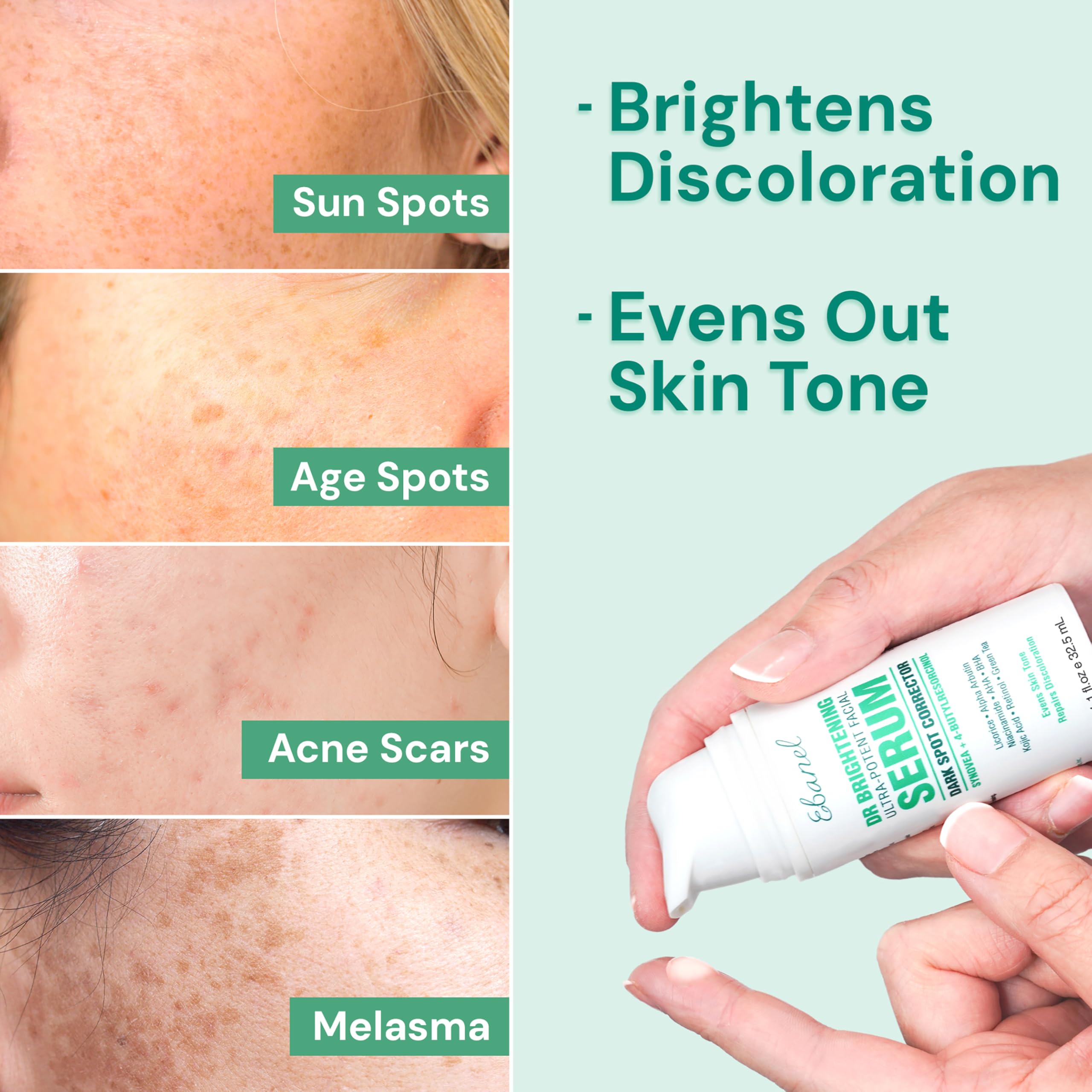 Ebanel Dark Spot Remover for Face & Body, Brightening Serum with Synovea HR, Alpha Arbutin, Niacinamide, Kojic Acid, Dark Spot Corrector for Hyperpigmentation, Discoloration, Melasma and Age Spots