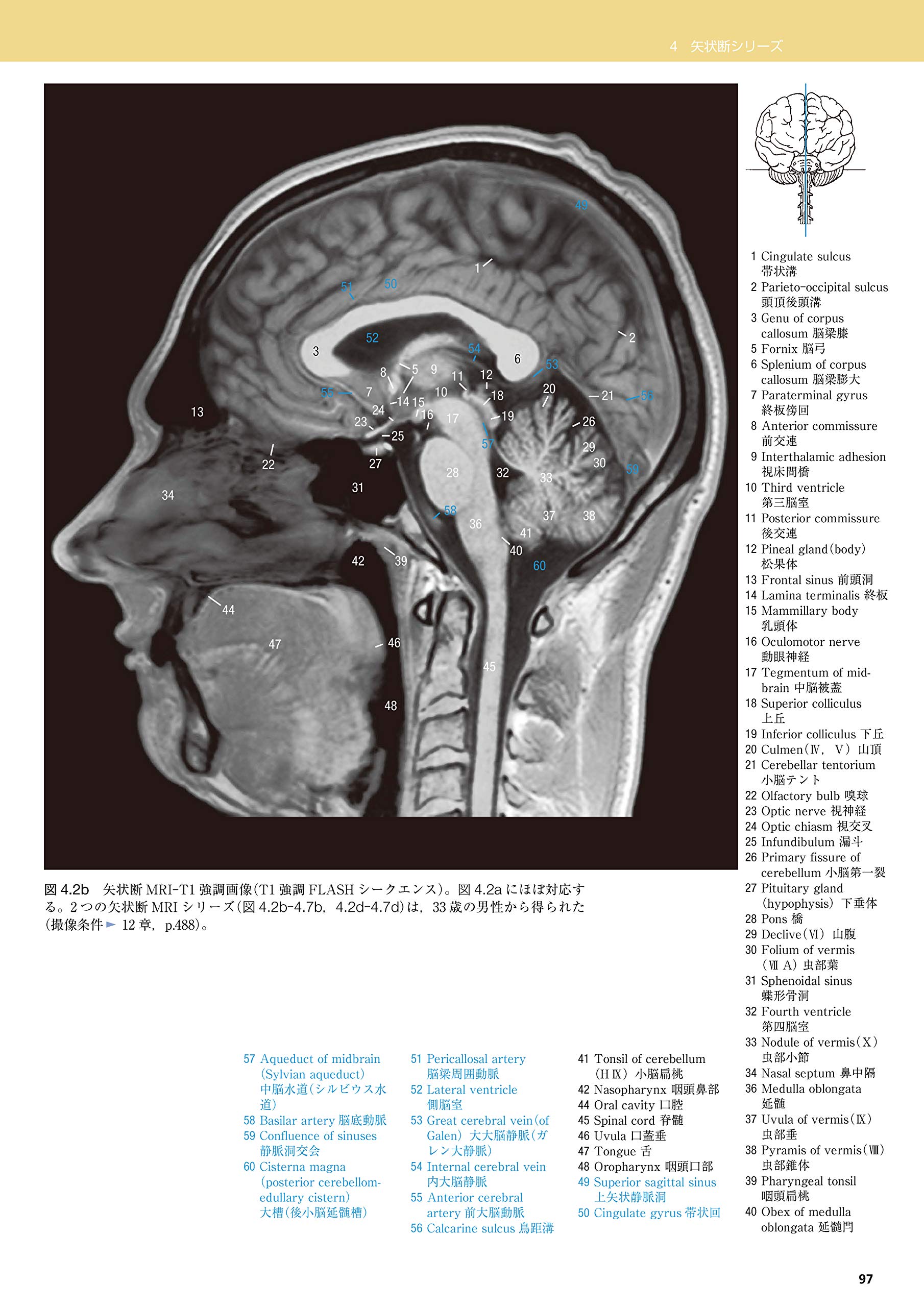 半額sale 裁断済み 脳の機能解剖と画像診断 第2版 健康 医学
