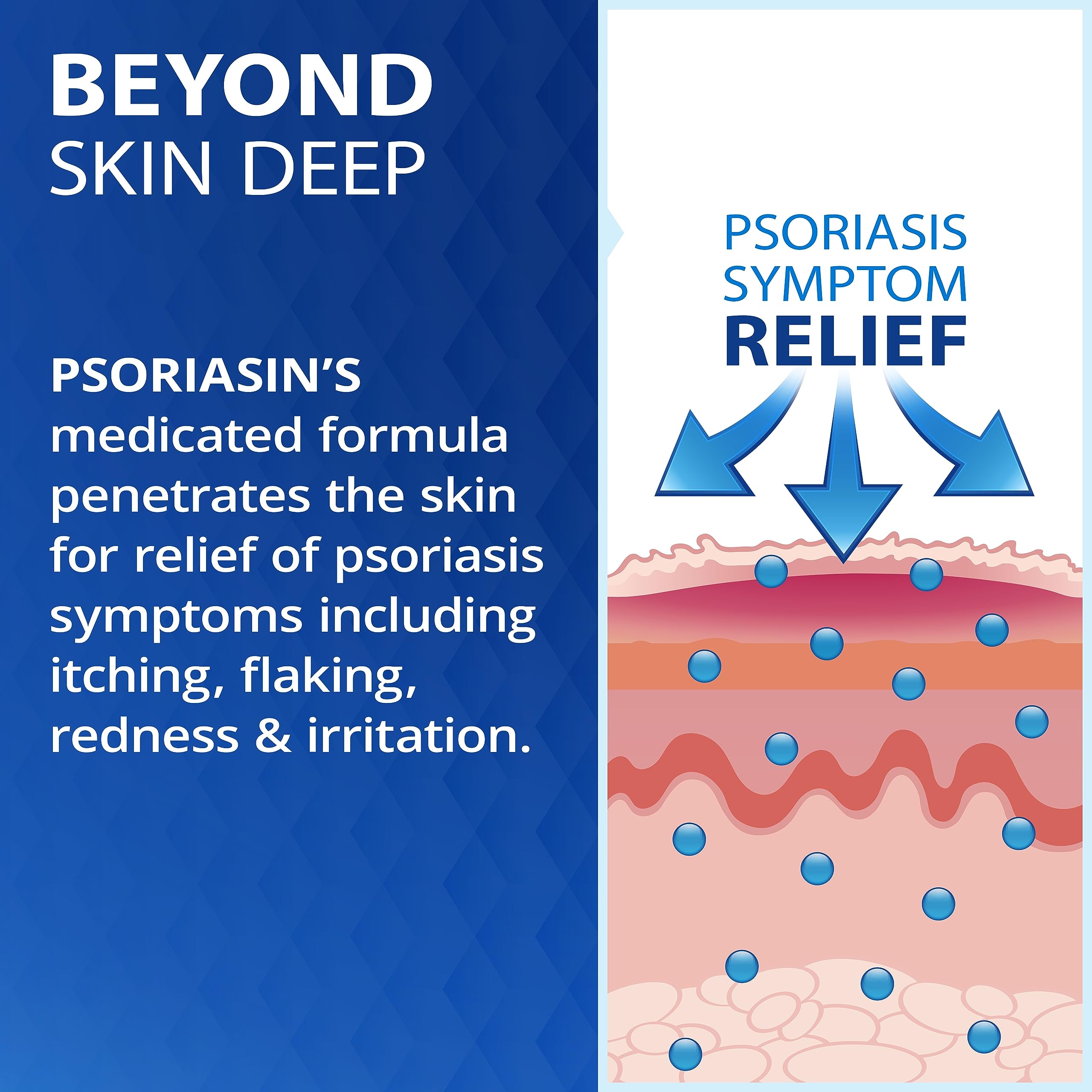 Psoriasin Daytime Relief Vanishing Gel - Stops Psoriasis Itching, Flaking, Redness - Twin Pack - Two 0.75oz Tubes (1.5oz Total)