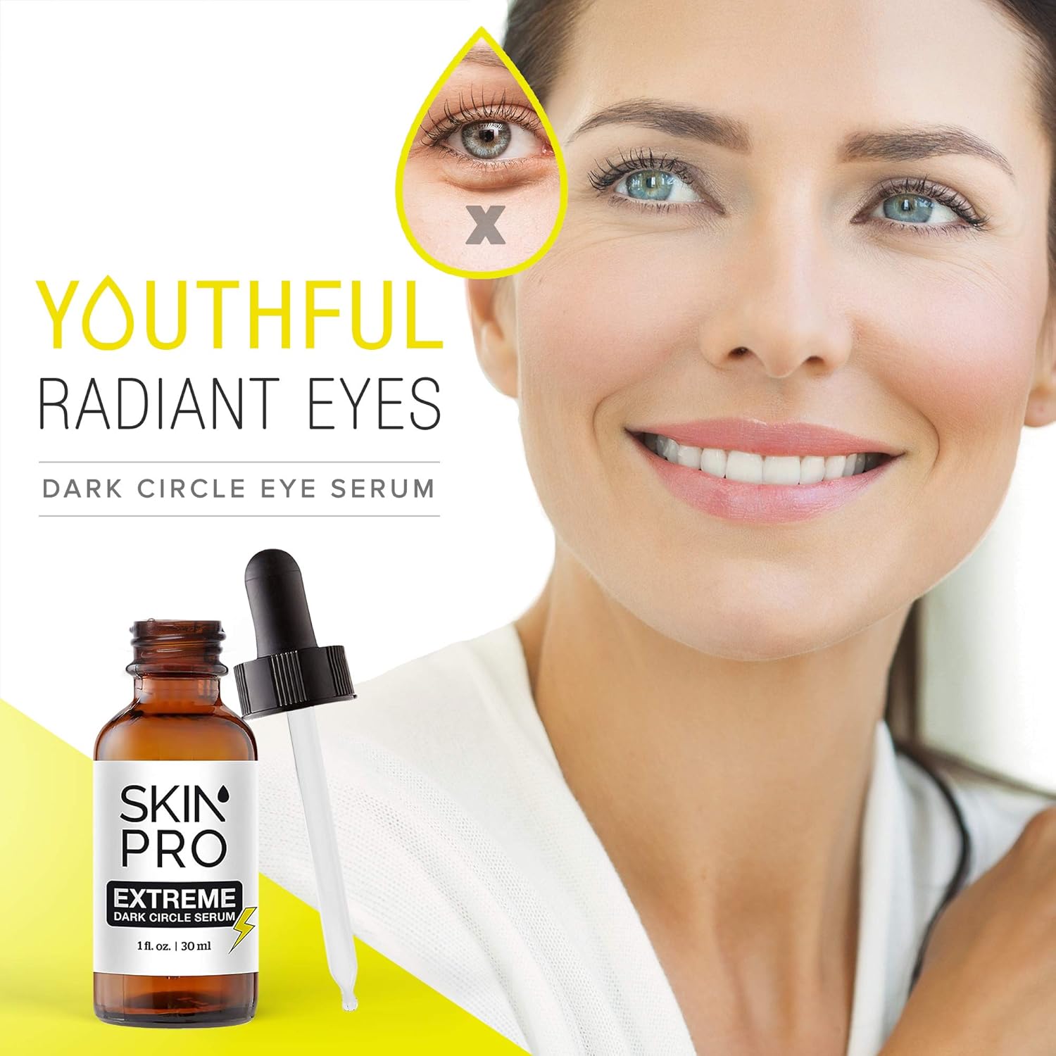 extreme dark circles treatment