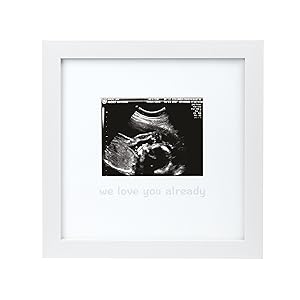 Tiny Ideas We Love You Already Sonogram Keepsake Photo Frame, White