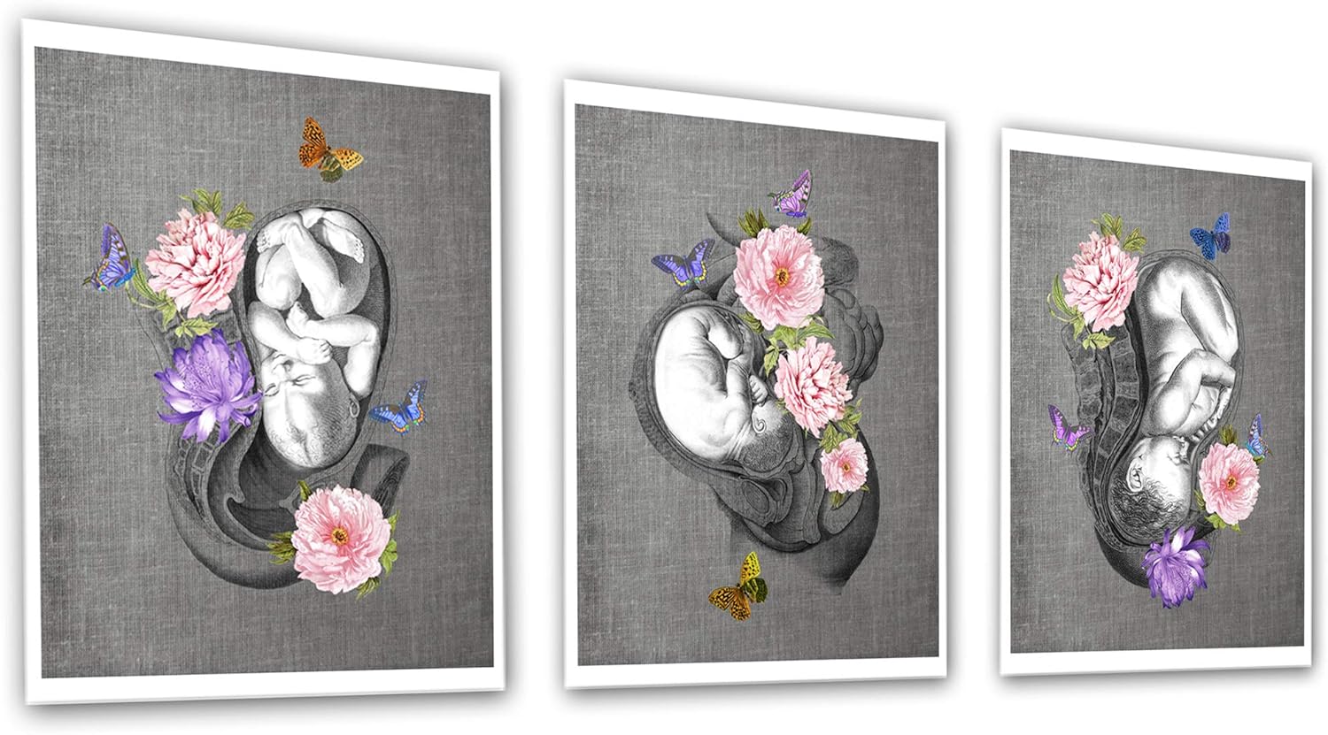 OBGYN Obstetrics Anatomy Floral Wall Art set of 3 unframed Medical Decor