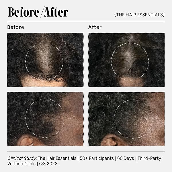 NÉCESSAIRE THE CONDITIONER. FRAGRANCE-FREE. HYDRATING TREATMENT FOR SCALP + HAIR. HYALURONIC ACID. HYPOALLERGENIC. DERMATOLOGIST-TESTED. NON-COMEDOGENIC. NO SILICONES. 250 ML / 8.4 FL OZ