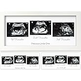 KeaBabies Baby Sonogram Picture Frames - Trio Ultrasound Picture Frames, First Time Mom Gift, Cute Pregnancy Reveal Photo Frame, Baby Gender Reveal Gift, Newborn Nursery Decor (Alpine White)