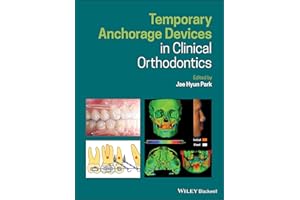 Temporary Anchorage Devices in Clinical Orthodontics