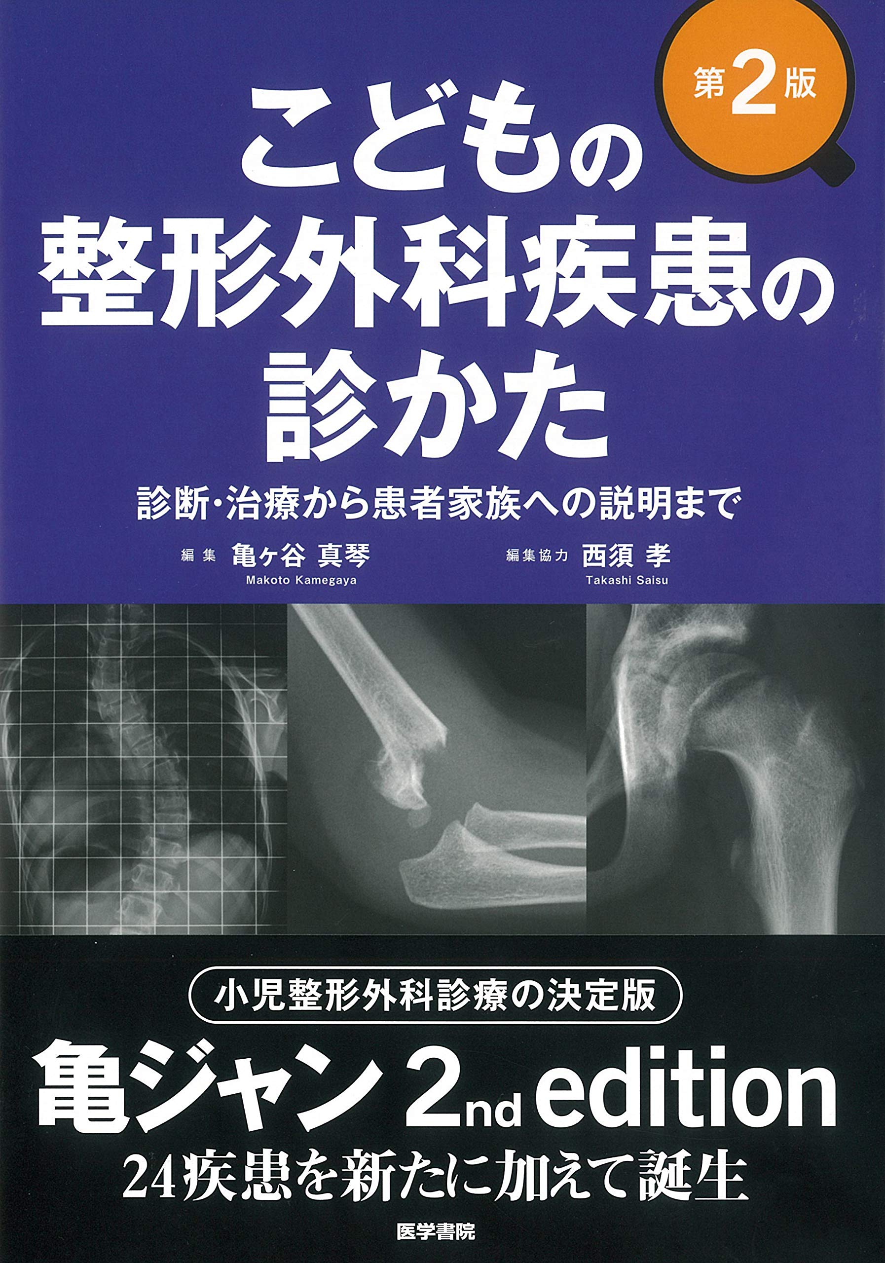 こどもの整形外科疾患の診かた 第2版 診断 治療から患者家族への説明まで 亀ヶ谷 真琴 本 通販 Amazon