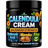 Healthergize Calendula Cream Maximum Strength &ndash; Soothing Face &amp; Body Cream for Dry, Sensitive Skin &ndash; with Manuka Honey, Hyaluronic Acid &amp; Aloe &ndash; Gentle Hydration, Paraben Free &ndash; 5.5 Oz, Made in USA