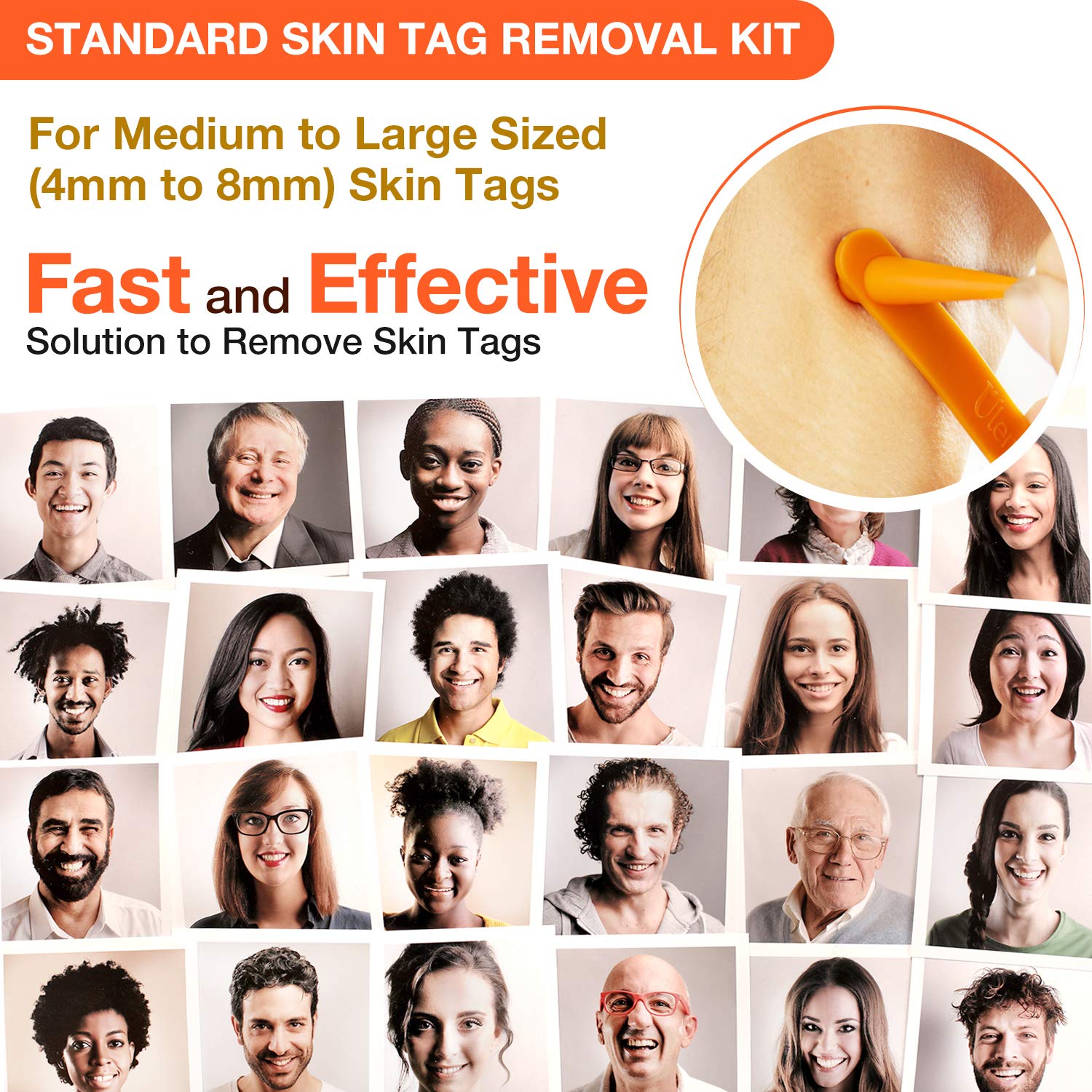 Ulensy Skin Tag Remover, Standard Skin Tag Removal Kit with 36Pcs Repair Patches for Face, Neck, Finger and Body, for Medium to Large (4mm to 8mm) Sized Skin Tags, Safe and Painless, Smooth Results : Beauty