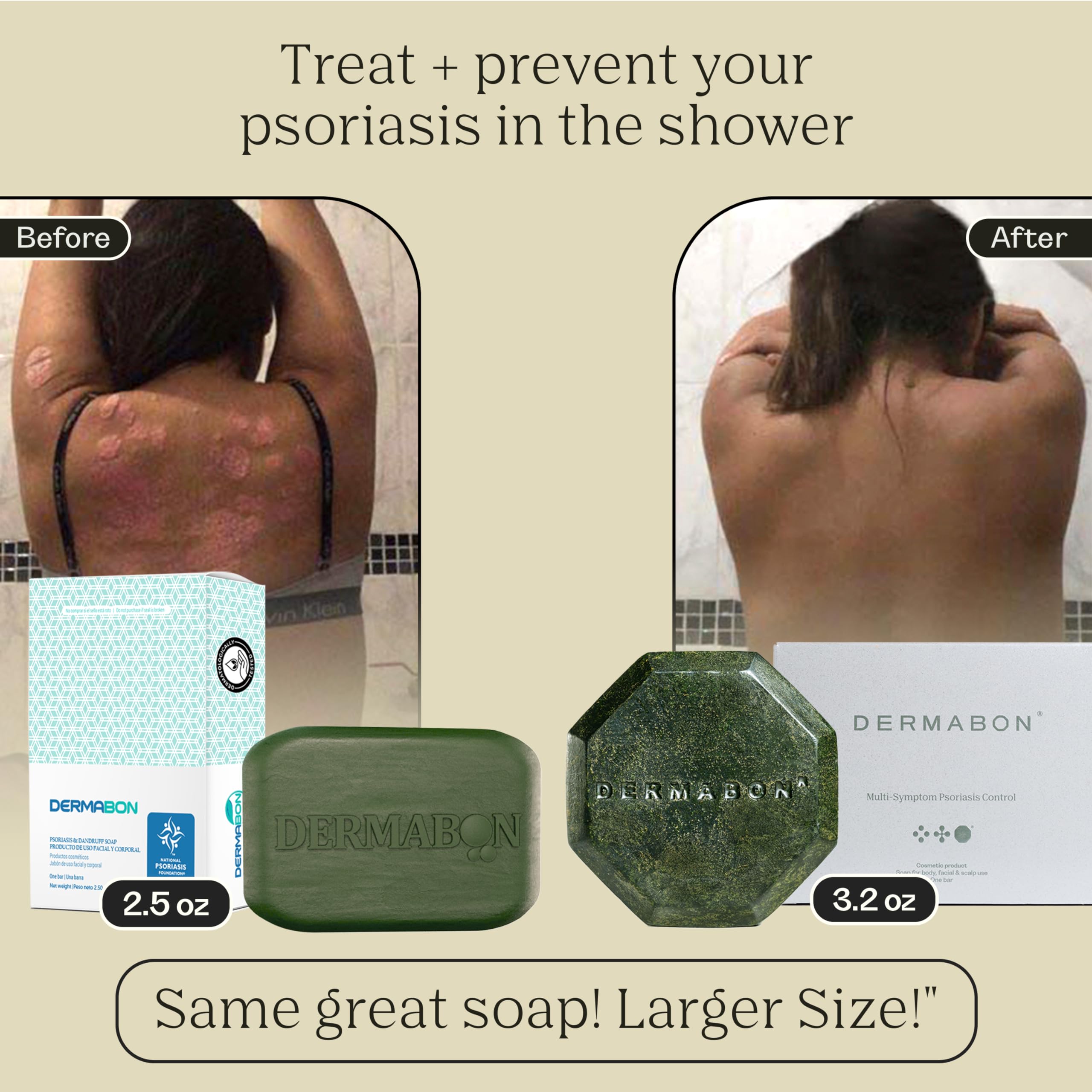 Mua Dermabon Psoriasis Cleanser, Seborrheic Dermatitis & Eczema Soap