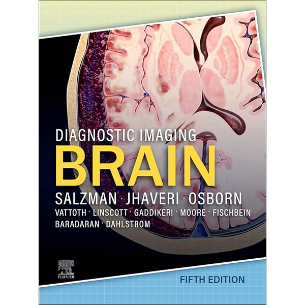 Amazon.com: Osborn's Brain E-Book eBook : Osborn MD, FACR, Anne G