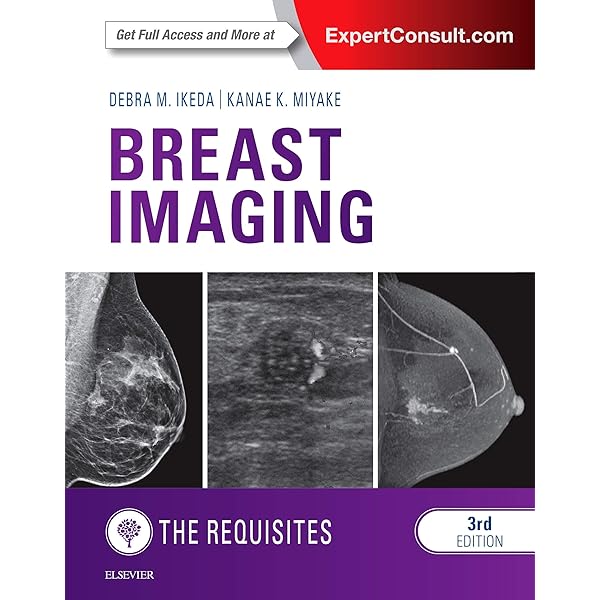 Diagnostic Imaging: Breast: 9780323548120: Medicine & Health