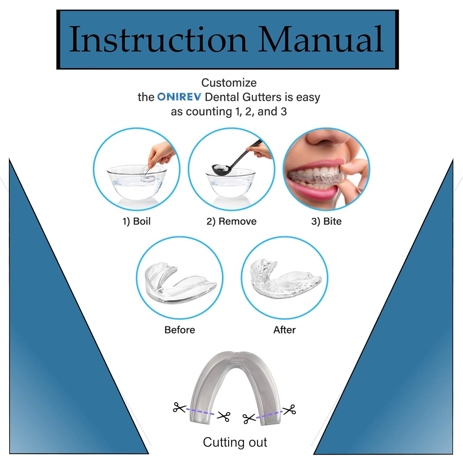[6 en 1]Férula dental anti bruxismo - dispositivo profesional - Termosensible - nocturno - tratamiento ATM - evita el rechinar de los dientes - ...