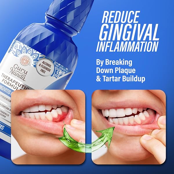 GURUNANDA HEALTHY GUMS MOUTHWASH FOR GINGIVITIS & BLEEDING GUMS – ANTIGINGIVITIS ORAL RINSE WITH 0.05% CPC – ALCOHOL-FREE, FLUORIDE-FREE PLAQUE CONTROL, WILD MINT – 16 OZ, PACK OF 2