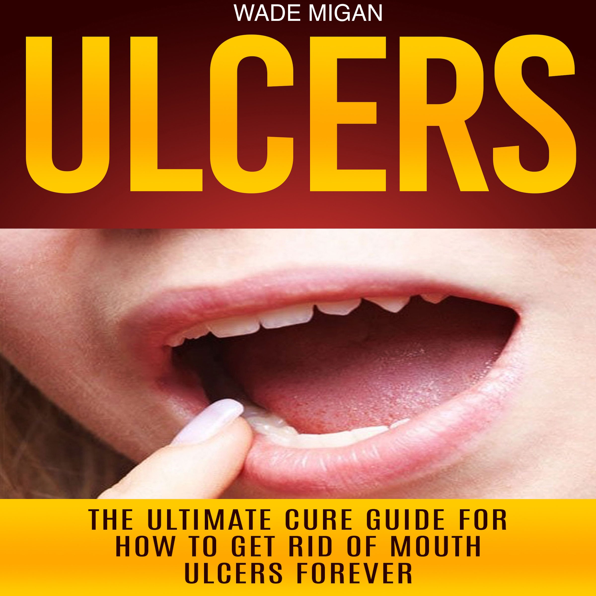 Ulcers The Ultimate Cure Guide For How To Get Rid Of Mouth Ulcers Instantly on Galleon Philippines