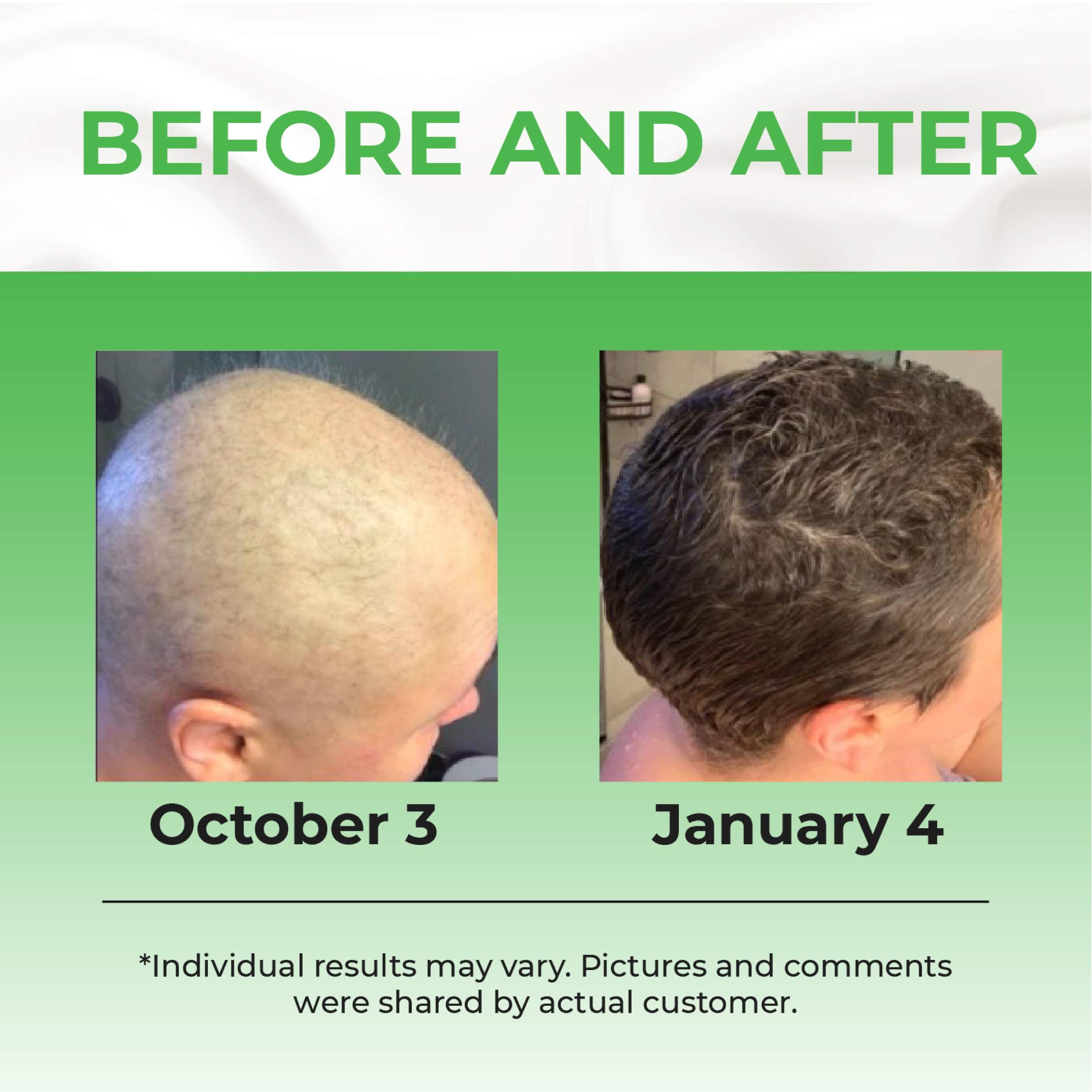 Biotin Hair Growth Serum Advanced Topical Formula To Help Grow
