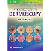 A Practical Guide to Dermoscopy