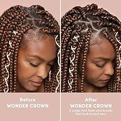 Mizani Wonder Crown Scalp Cleanser | Dry Scalp and